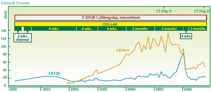 子宮內膜癌復發伴隨遠處轉移案例圖2